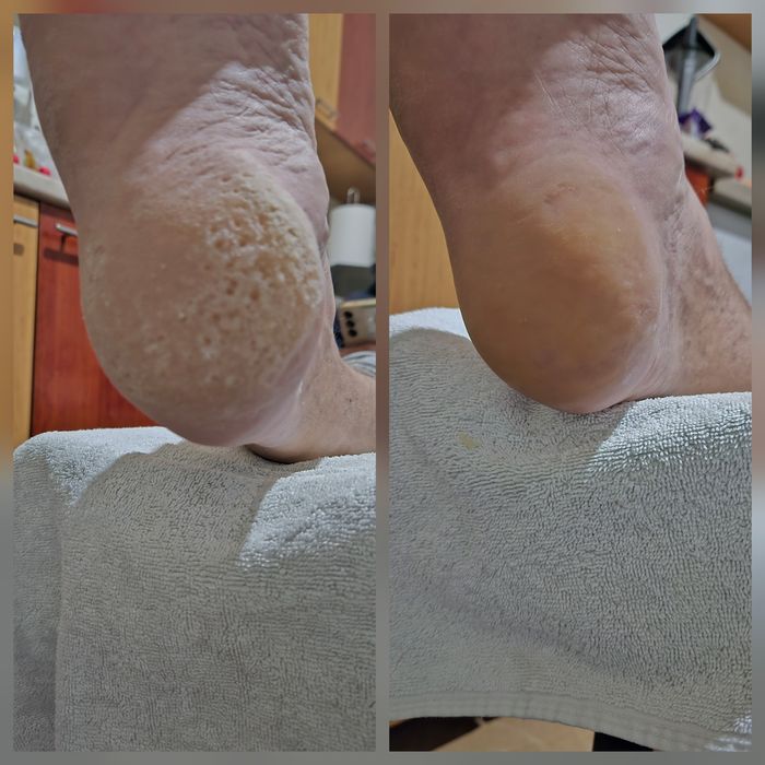 Pedichiură clasică și medicală