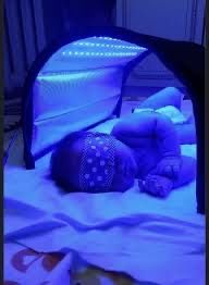 Фотолампа Fotolampa Фотолампа от желтухи