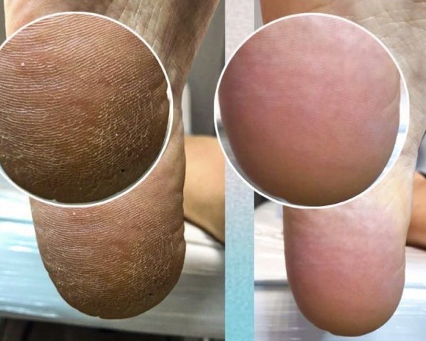 Гель лак, наращивание ногтей, педикюр