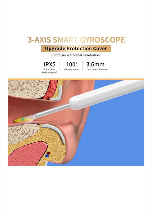 Наличен Отоскоп за уши, нос, гърло, зъби, тен, NE3 WIFI, LED светлина,