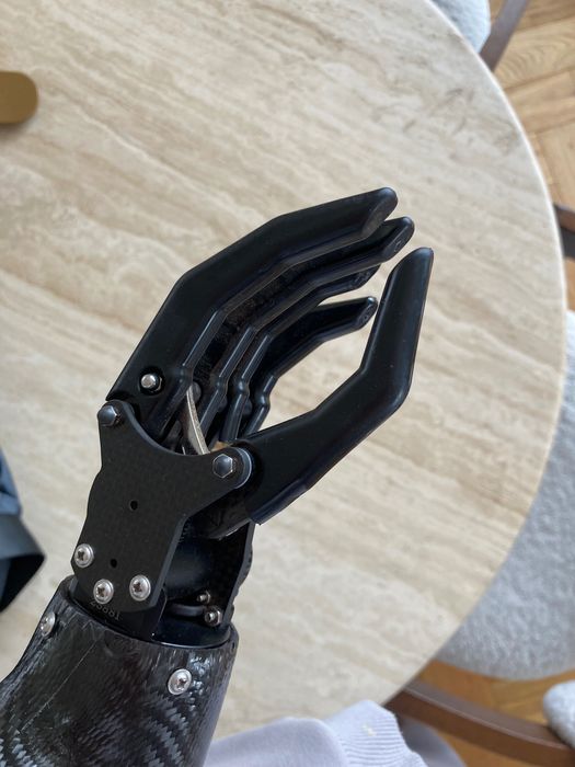 Протеза за ръка (миоелектрична)