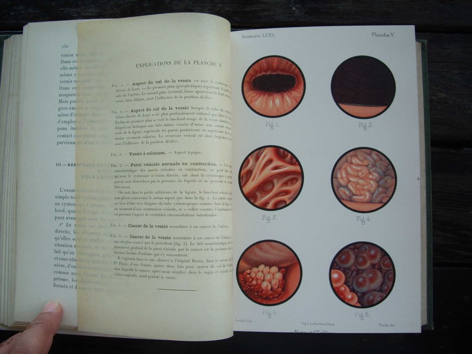 Медицинска книга Изследване на уринарната система, 1909 , френска