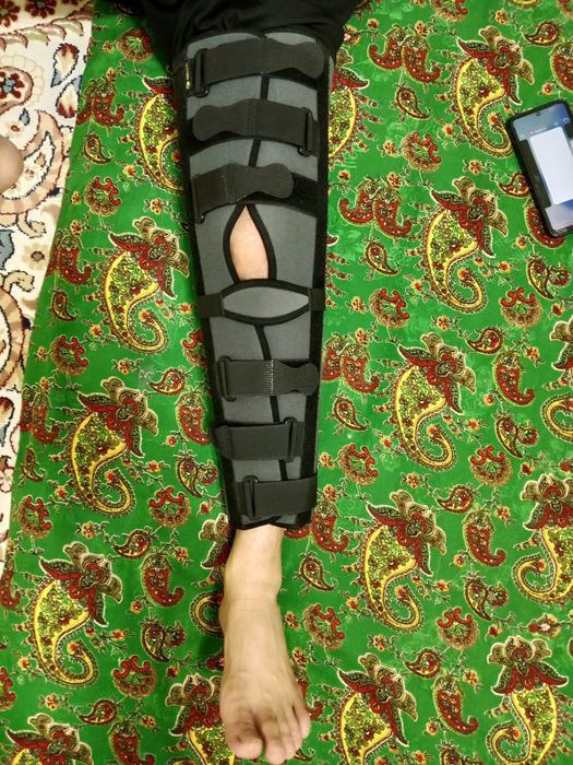 Коленный ортез (тутор) на коленный сустав.