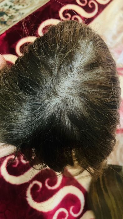 Макушка табиий соч ва зажимли улама соч (Алохида хам сотилади)