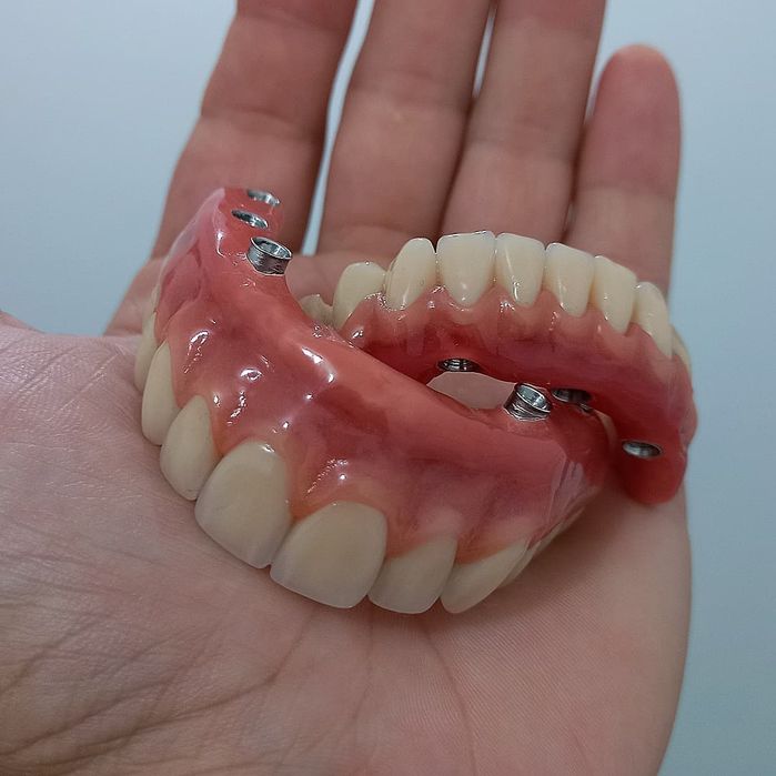 Протезы любой сложности