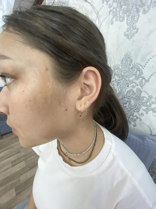 Прокол ушей стадекс