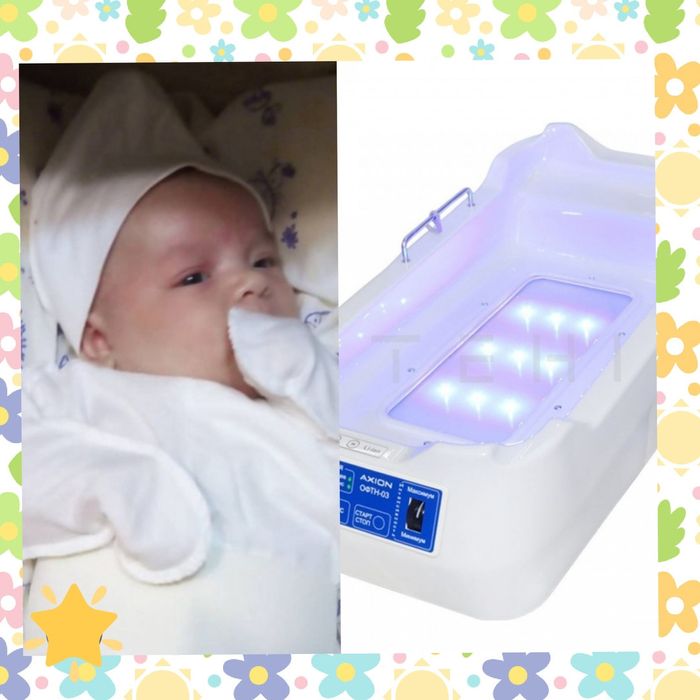 Фотолампа от желтухи