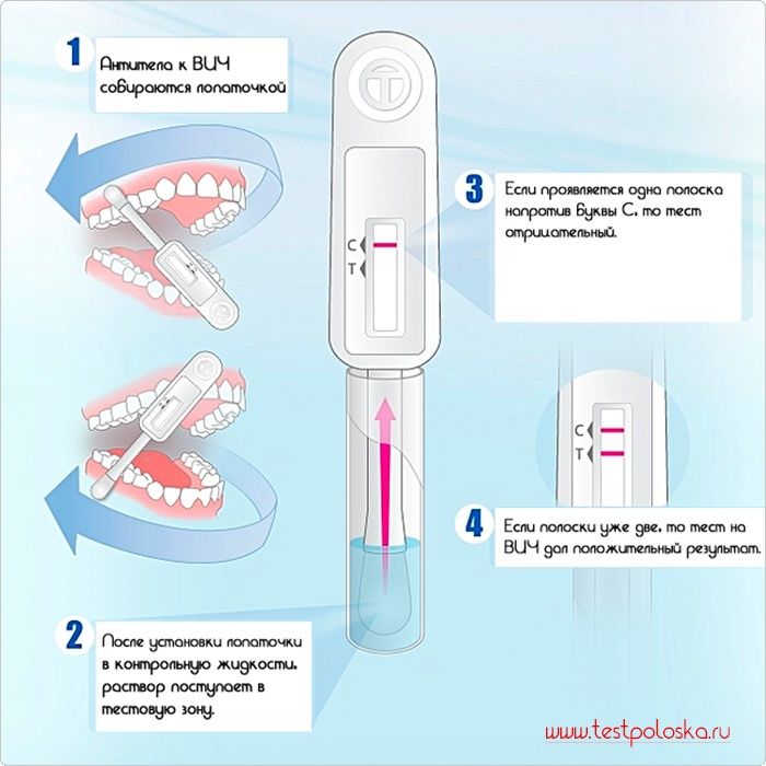 Экспресс тест на ВИЧ