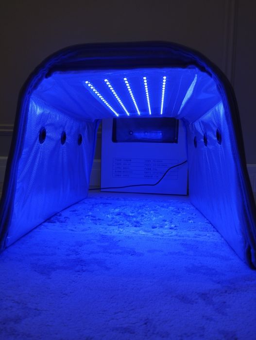 Лампа от желтушки