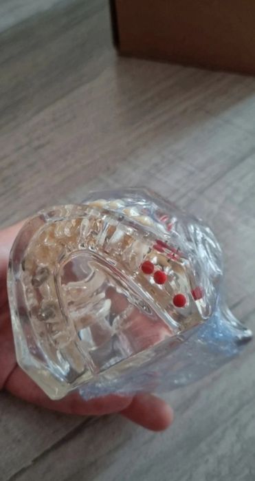 Model dentar multiple patologii