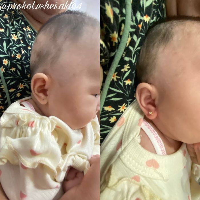 Прокол ушей стадекс