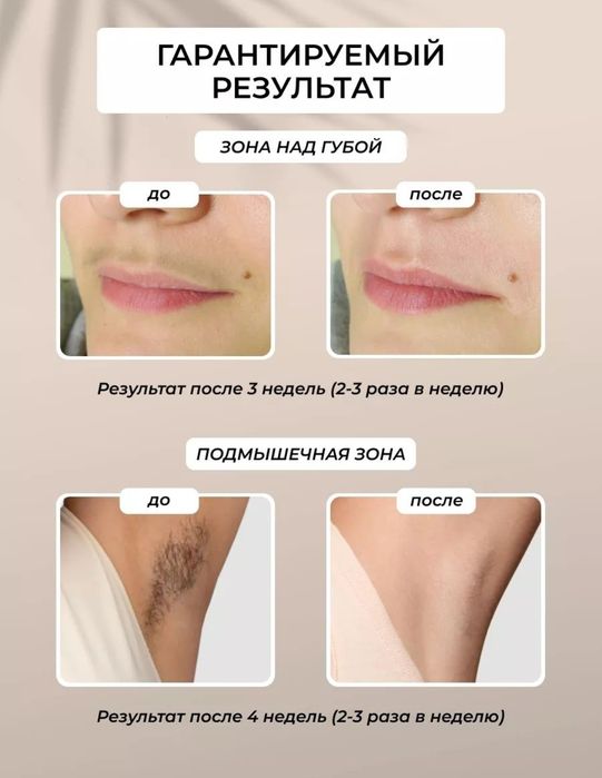 Фотоэпилятор Doctor comfort 2в1 омоложение и антиакне