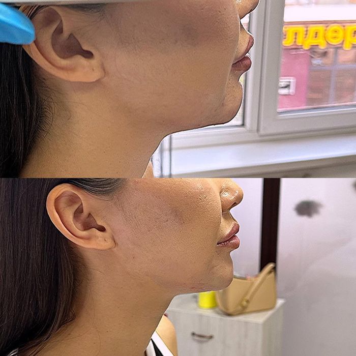 Косметолог на дому