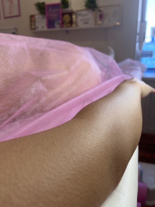 Депиляция: шугаринг, воск, полимер, эластомер