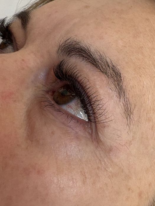 Gene/extensii gene fir cu fir