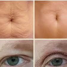 Продам плазма ручку