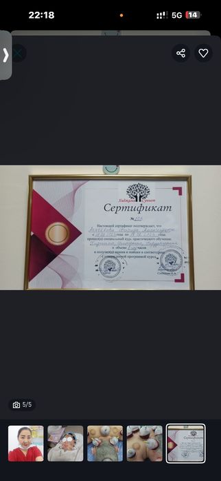 Хиджама у себя и на выезд стерильно