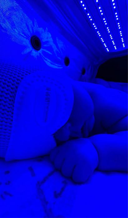 Лампа от желтушки