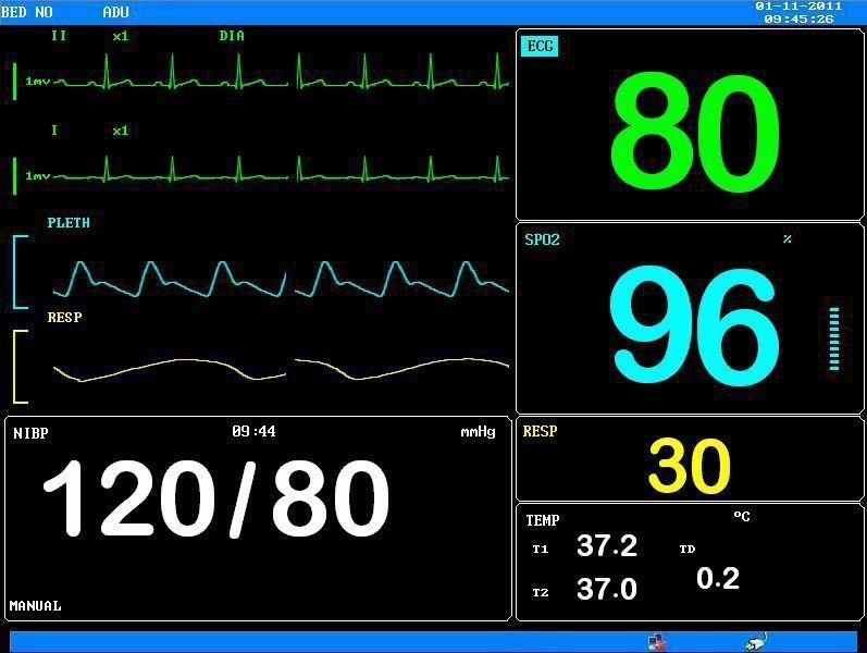 Монитор пациента/многофункциональный монитор