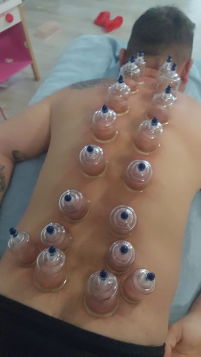 Chiropractică, Terapia Trigger Point ,IASM și Complementară