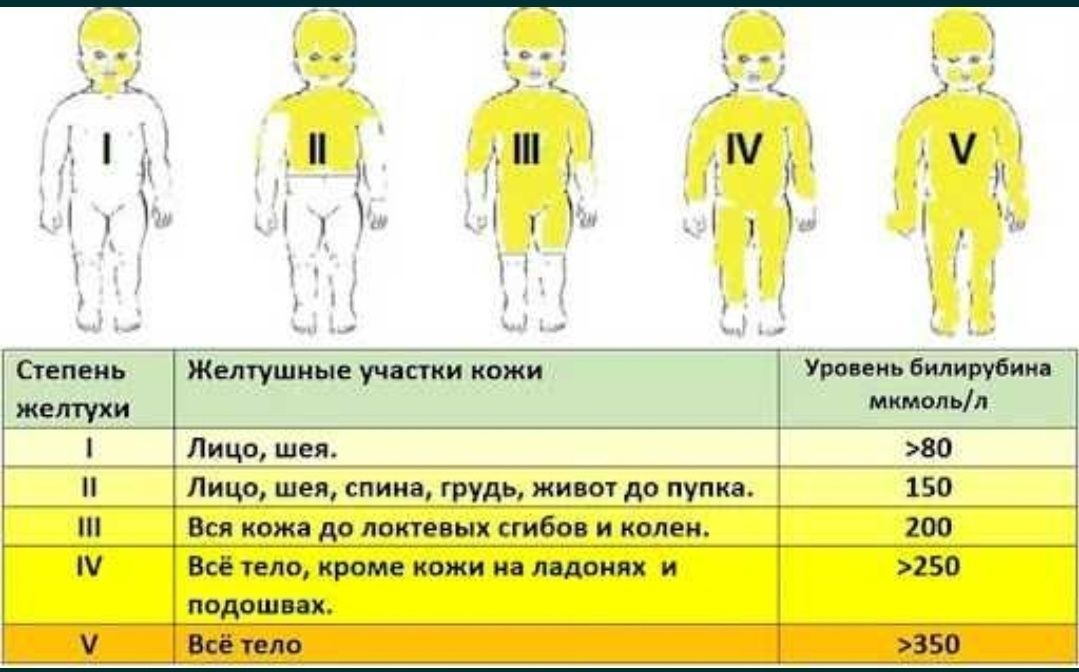 Дети 2 степени. Желтушка у новорожденных нормы показателей. Показатели нормы по желтушка у новорожденных. Норма уровня желтушки у новорожденных. Билирубин у новорожденных норма физиологическая желтушка.