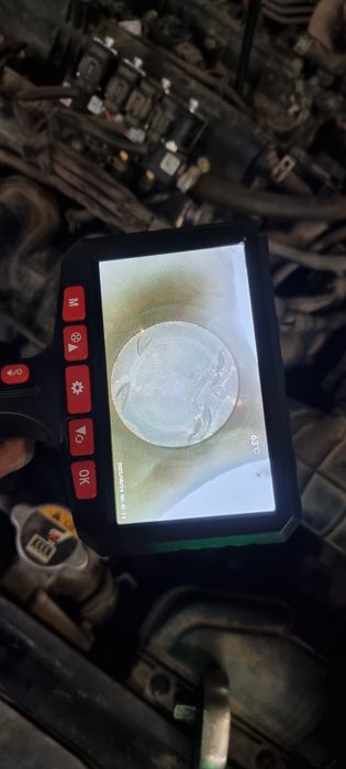 Услуги эндаскоп на выезд