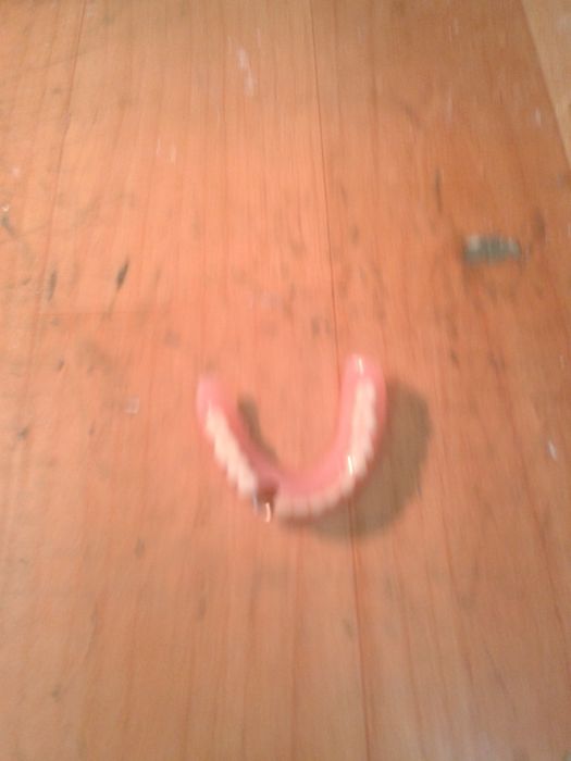 Продам протезы съёмные