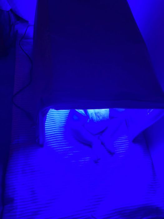 Фотолампа продам желтушка срочно