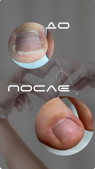 Мастер педикюра-подолог