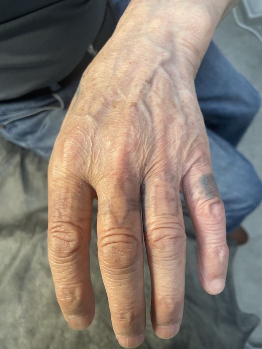 Удаление тату и татуажа