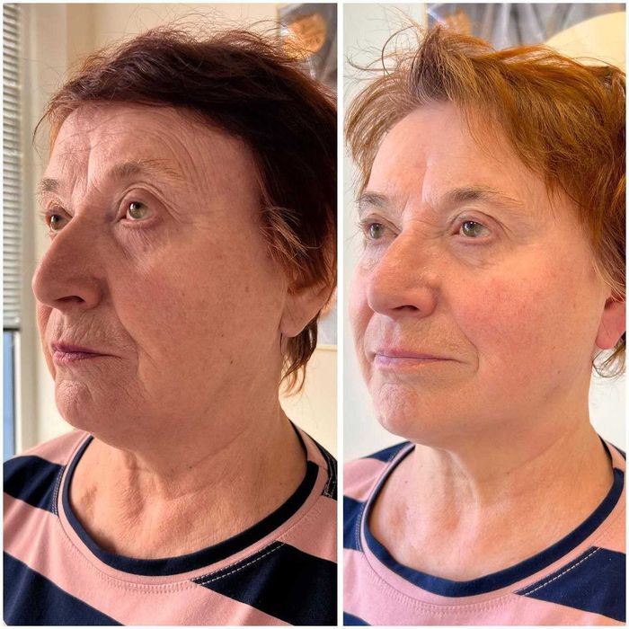 Kosmetologiya | Yuzni tozalash, parvarish, pilinglar