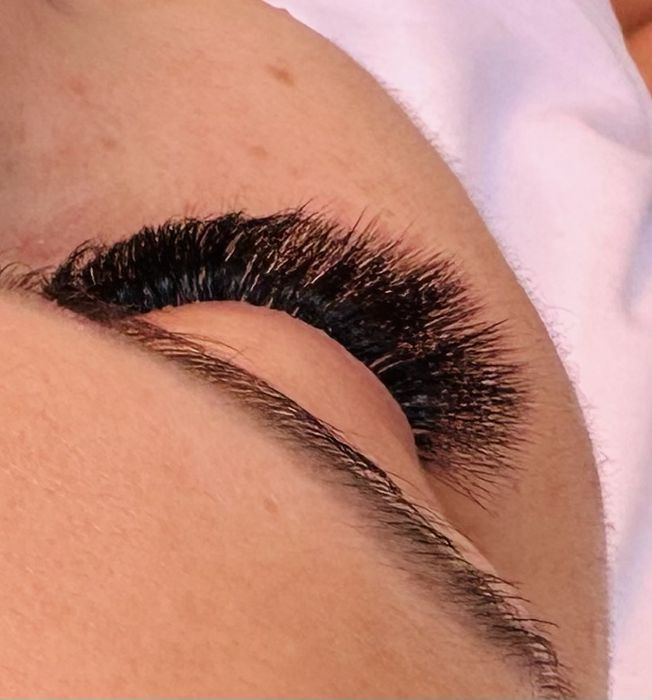 Extensii de gene- Satu Mare