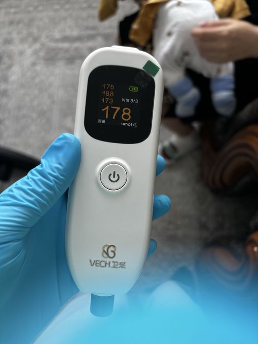 Аппарат для измерение биллирубина