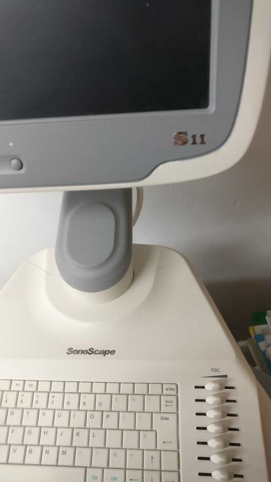 Ехограф Sono Scape S11