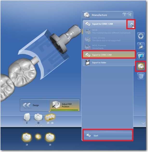 coDiagnostiX 10.4 под ключ для CAD/CAM лаборатории