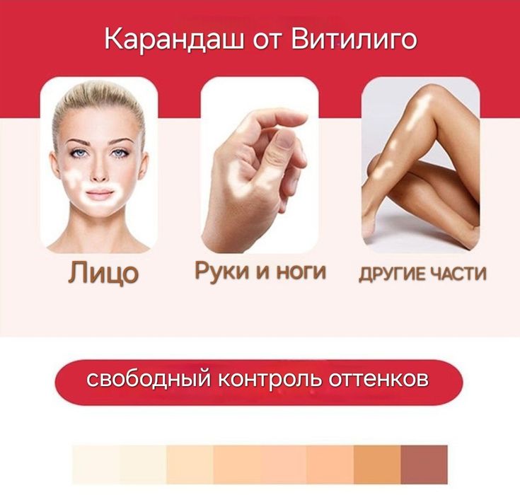 Тональный маскирующий карандаш от Витилиго фломастер от белых пятен