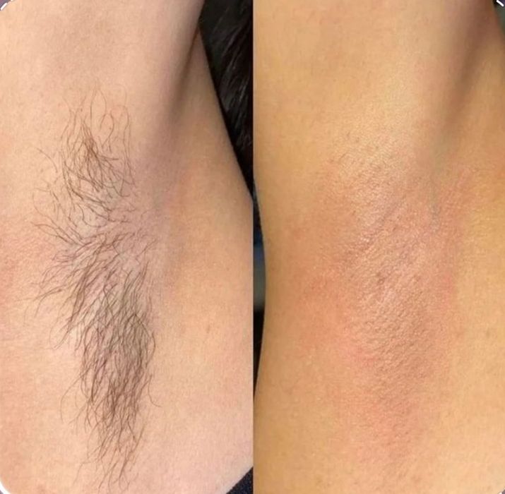 Депиляция хизмати. Кош ламинация .Арзон  ва сифатли. Чакирувга хам чик