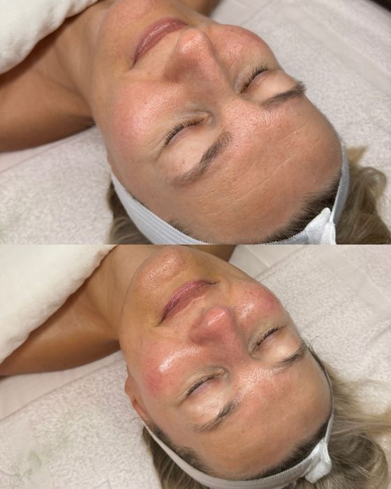 Нужна модель на косметологияческие процедуры