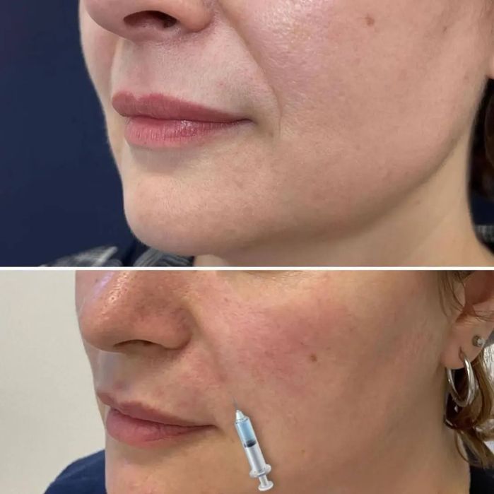 Filler quydik labga dahanga nosagubkaga