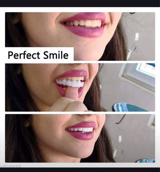 виниры для зубов съмнве