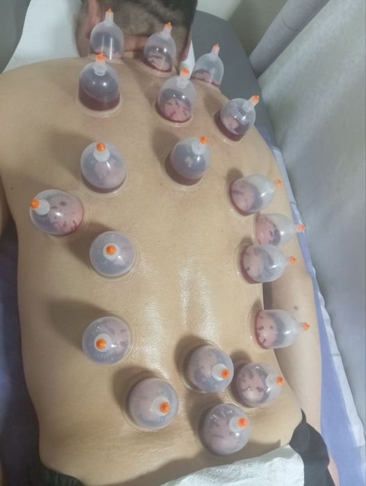 Hijoma zuluk med pratsedura