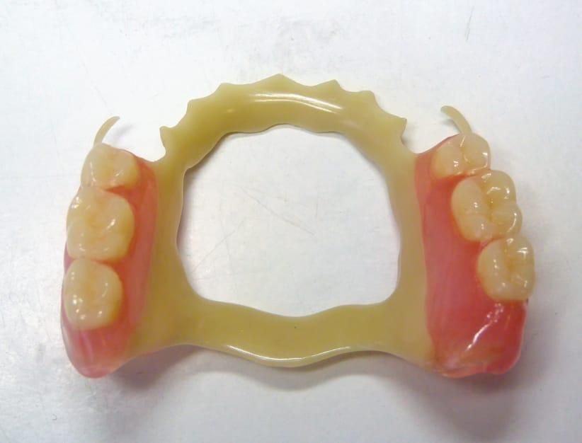 Сьемные Протезирование