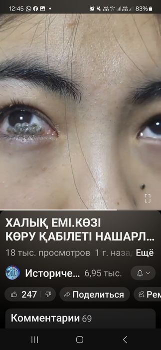 Орама дәні көзге шипа!