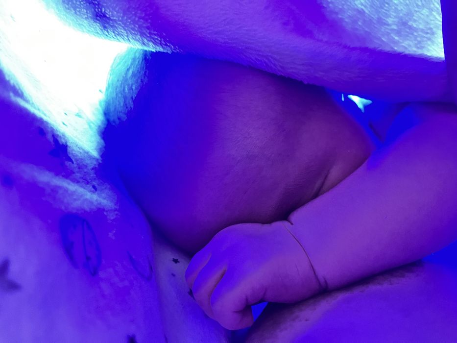 Лампа от желтушки