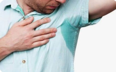 Gipergidroz, Qultik terlashi