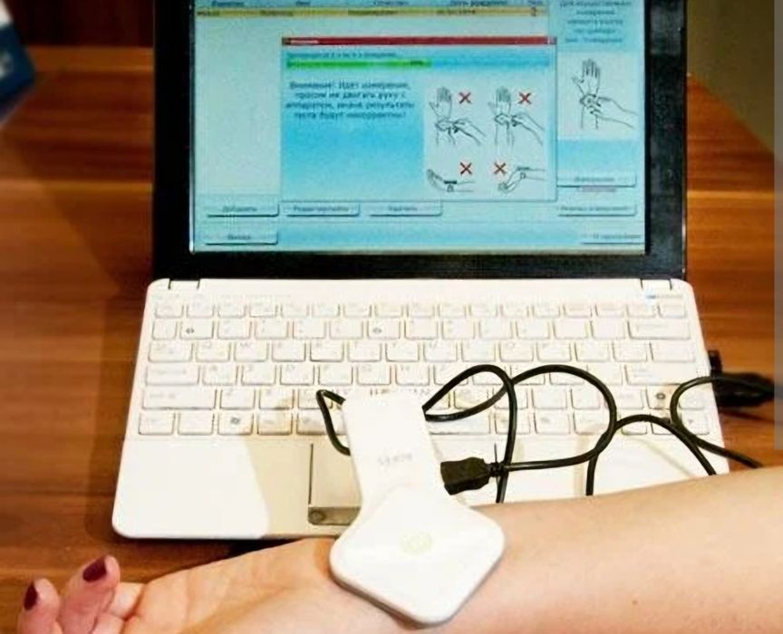 Рофес аппараты / Рофэс / Аппарат рофес / Rofes