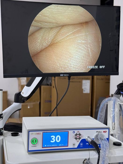 Лор эндоскоп, лор видео система SPACEMED FULL HD