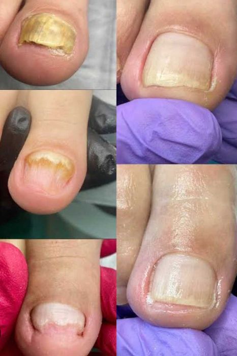 55 Lei Ofer sercivii de cosmetizare calcaie si pedichiura cosmetica  la domiciliul clientei - Bucuresti
