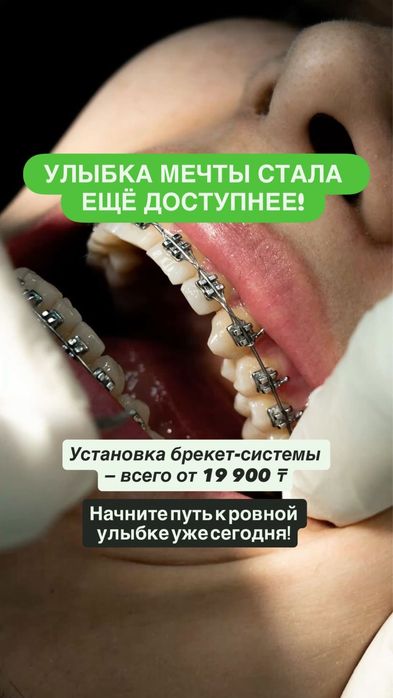 брекеты -от 19,000тг акция