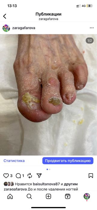 Мед педикюр и продам куртку